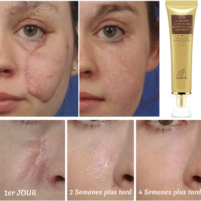Crème anti-cicatrices